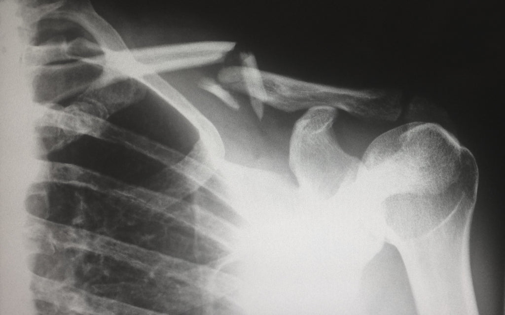 Where to recycle x-rays in Australia